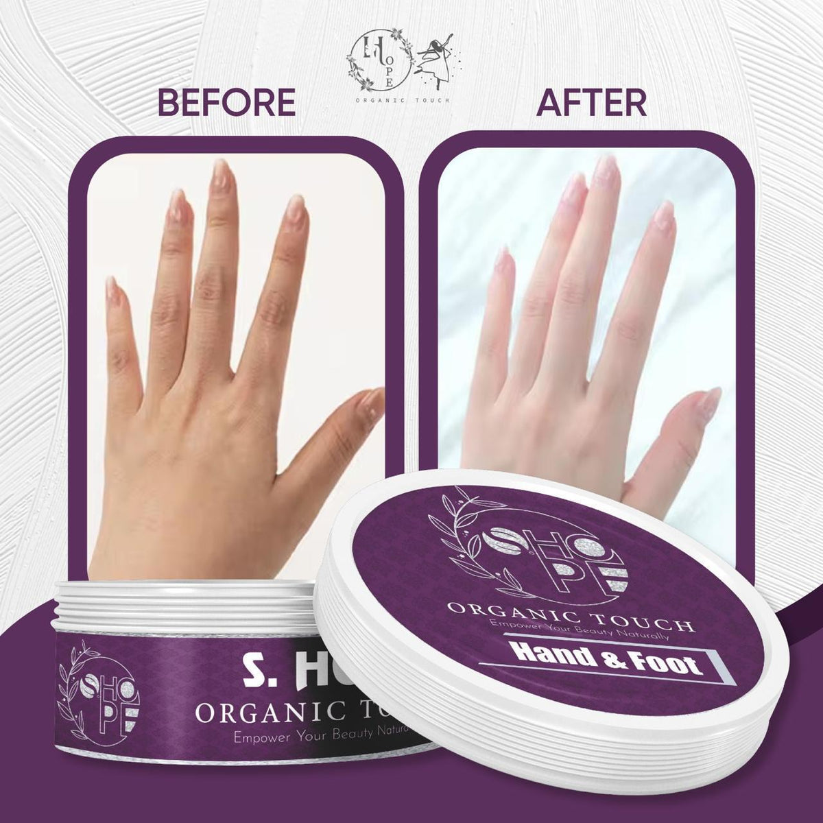 ✨ ShopeOrganic Radiant Touch – Hand & Foot Whitening & Repair Cream | Soft, Bright & Spotless Skin